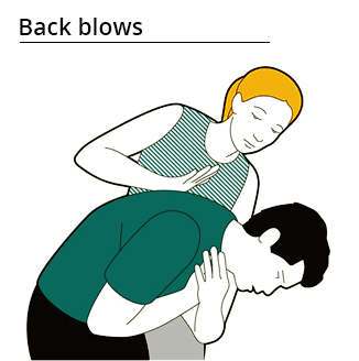 Back blows - method applied in first air to remove obstructions and allow breathing